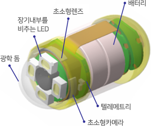 캡슐내시경 구조 - 광학 돔, 장기내부를 비추는 LED, 초소형렌즈, 배터리, 텔레메트리, 초소형카메라